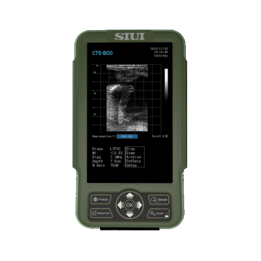 CTS-800 kannettava ultraäänitutkimuslaite 3