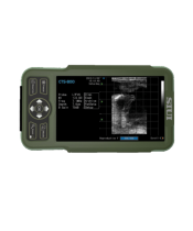 CTS-800 kannettava ultraäänitutkimuslaite 4