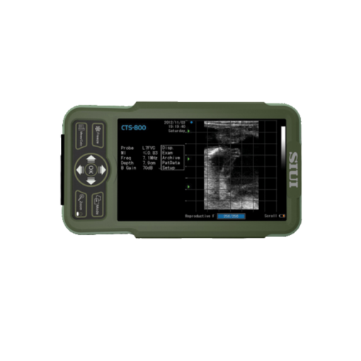 CTS-800 kannettava ultraäänitutkimuslaite 2